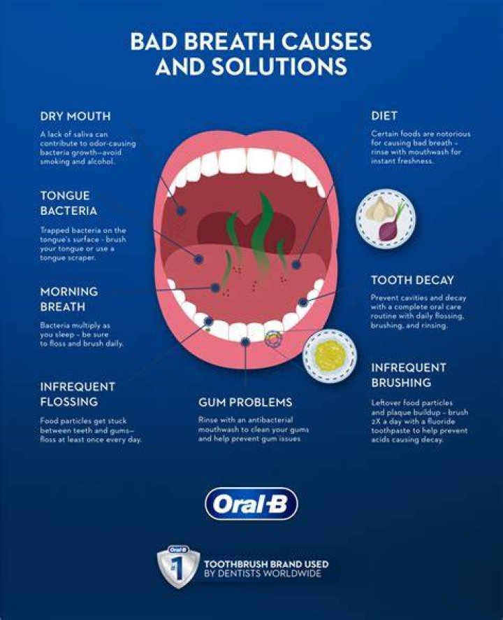 How can I get rid of my baby's bad breath?