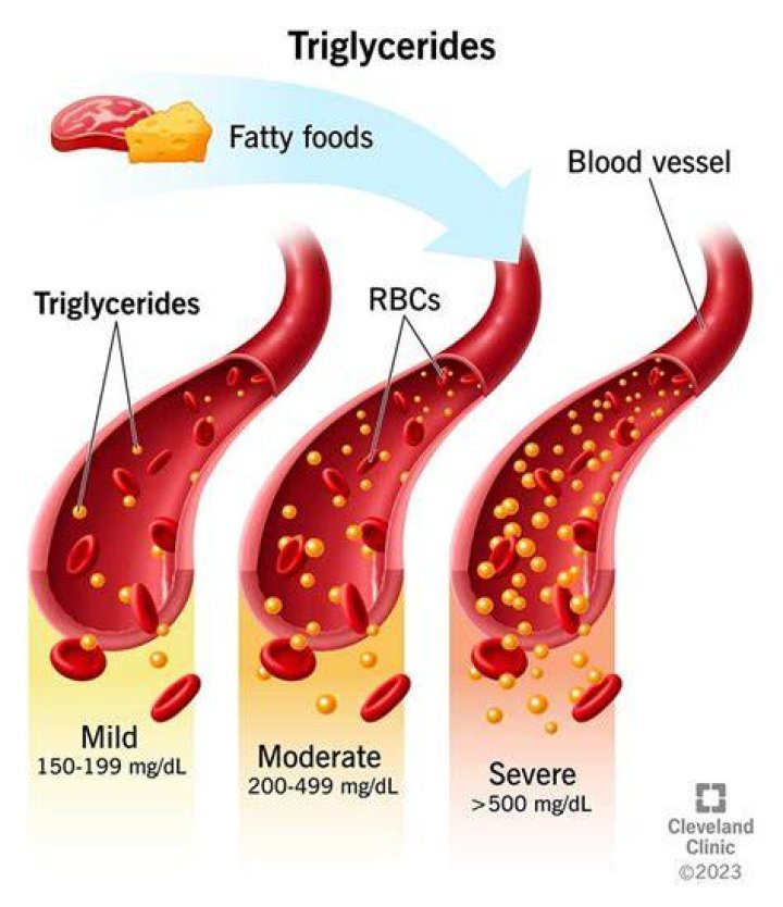 How do triglycerides affect heart disease?