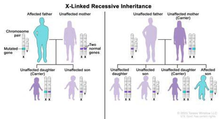 Is Down Syndrome dominant recessive or X linked?