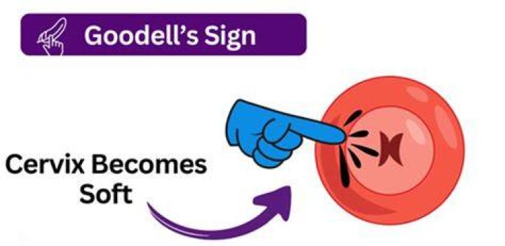 What is Goodell's sign? | ContextResponse.com